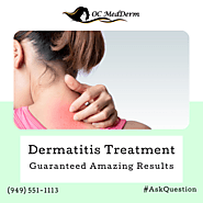 Dermatitis Treatment Irvine & Orange county