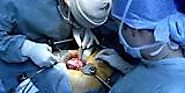 Liver Transplant in India | Transplant Counsellor