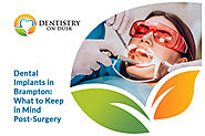 Dental Implant Surgery in Brampton: What You Can & Can’t Do Afterwards