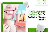 Dental Implant Treatment Options for Missing Teeth | Dentistry on Dusk