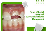 Get Rid of Dental Injury with Trauma Management in Brampton