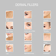 Dermal Lip Filler Treatment