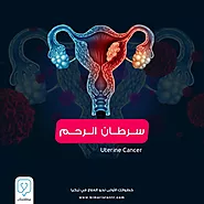 سرطان الرحم_uterine cancer_ الأعراض والعلاج لسرطان بطانة الرحم