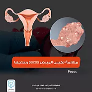 متلازمة تكيس المبيض pcos وعلاجها في تركيا - بيمارستان