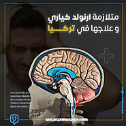 علاج متلازمة ارنولد كياري في تركيا - بيمارستان