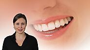 Solana Smiles - Full Mouth Dental Implants in Solana Beach CA