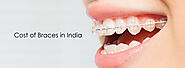 Cost of Braces in India - Cosmodent India