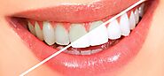 Home Remedies To Get Dazzling White Teeth For A Naturally Brilliant And Appealing Smile