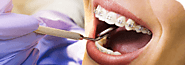 Orthodontics Melbourne | Services | Lentini Dental