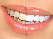 Ipswich teeth whitening Ipswich dentist