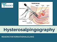 Hysterosalpingography - What Is, Why we Need