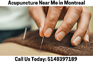 Acupuncture Near Me in Montreal
