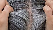 Top Grey Hair Treatment to Prevent White Hair From Spreading