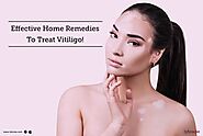 5 Best Home Remedies To Treat Vitiligo Diseases - By Dr. Ravish Kamal | Lybrate