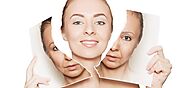 5 Anti-Aging Treatments Which Are Effective In Reducing Fine Line And Wrinkles - Aesthetics By DrJyoti