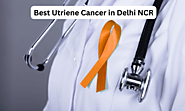 Best Uterine Cancer Treatment Doctors in Delhi