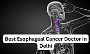 Best Esophageal Cancer Doctor in Delhi NCR | Dr. Dodul Mondal