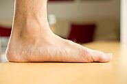 Flat Feet: Symptoms, Exercises, Diagnosis, And Treatment | Blueprint Podiatry