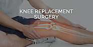 partial Knee Replacement Surgery in Gurgaon, Jodhpur, Mumbai, Bangalore