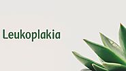 Leukoplakia - Symptoms, Causes, and Treatment