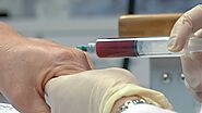 Platelet-rich plasma - Wikipedia