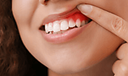 5 Simple Tips to Keep Your Gum Healthy: Say Goodbye to Gum Disease