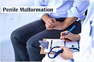 Penis Malformation Treatment in Lahore | Zaib Hospital