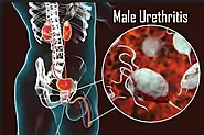 Male Urethritis Treatment | Chinese Hospital Lahore