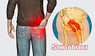 Sciatica Treatment in Lahore | Non Surgical Sciatica Treatment