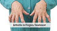 Arthritis in Fingers Treatment | Hand Arthritis | Pain Hospital Lahore