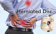 Lumbar Herniated Disc Treatment | Non-Surgical and Surgical