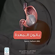 Gastric balloon procedure for slimming in Turkey/Istanbul - Bimaristan