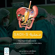 Single Anastomosis with Sleeve Gastrectomy (SADI-S) in Turkey - Bimaristan