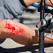 How to Improve Your Motorcycle Accident Injury’s Case Value