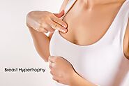 Breast Hypertrophy Treatment - Zaib Hospital | Dr. Goufen Liu