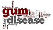 Different Types of Gum Disease: A Comprehensive Guide