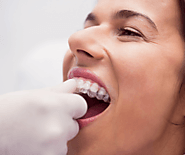 Are You Searching For The Top Dental Clinics For Invisible Braces In Kolkata?| Mission Smile