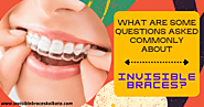 Find Out Some Of The Most FAQs About Invisible Braces| Invisible Braces Kolkata
