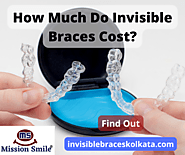 What Is The Cost Of Invisible Braces? – Invisible Braces Kolkata
