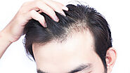 Regrow Hair And Prevent Hair Fall