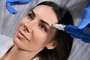 Refresh Your Skin with Microneedling in Suffolk