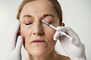 Unlocking the Benefits: Microneedling for Wrinkles