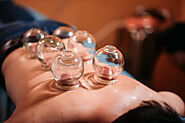 Cupping Therapy in Chennai - Jayanth Acupuncture Clinic | Best Cupping Treatment Center
