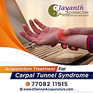 Acupuncture Treatment For Carpal Tunnel Syndrome in Chennai - Jayanth Acupuncture