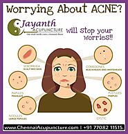 Acupuncture Treatment For Acne / Pimples in Chennai by Well Experienced Acupuncture Doctor