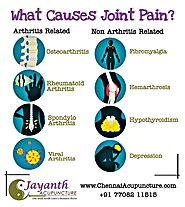 Acupuncture Treatment For Joint Pain in Chennai | Jayath Acupuncture Clinic