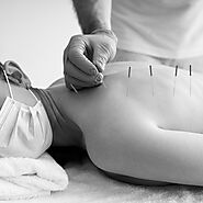 Dry needling, Chiropractic, Muscle therapy - Archetype