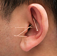 Acupuncture to Stop Smoking | Acupuncture to Stop Smoking Philadelphia