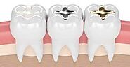 Website at https://www.royalclinicdubai.com/en-ae/general-dentistry/dental-tooth-filling/
