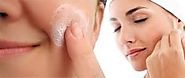 Adult Acne-Pimple Treatment-Solution For Pimples